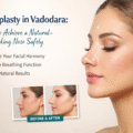 Rhinoplasty in Vadodara: How to Achieve a Natural-Looking Nose Safely