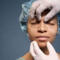 Complete Guide to Plastic Surgery with a Plastic Surgeon in Vadodara
